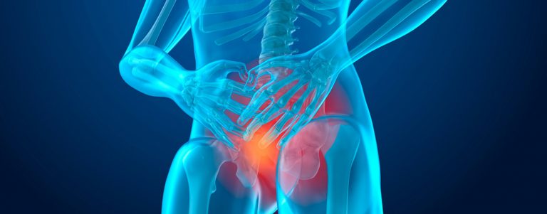 Prostatitis Bacteriana Aguda - Urólogo en Guadalajara Prostatitis Bacteriana Aguda